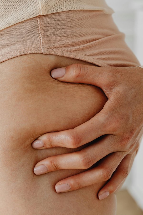 Top 5 solutions naturelles pour apaiser l'irritation anale